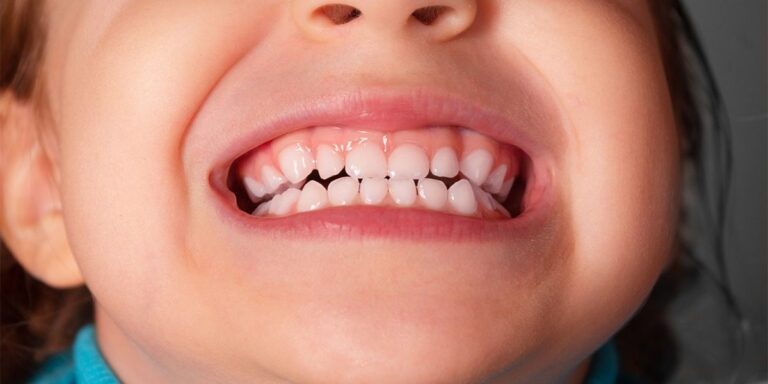 ‘t Natuurlijk Huus: Suiker